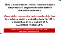 Epidemiologie zhoubného melanomu kůže  v ČR a její důsledky